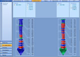 Bio Resonance Intellectual Scanner. Photo 10