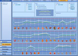 Bio Resonance Intellectual Scanner. Photo 7